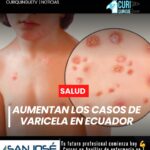 El Ministerio de Salud Pública mantiene una alerta sanitaria tras el incremento de casos de varicela en el país. En lo que va de 2026 se han registrado más de 4.000 contagios, una cifra superior a la reportada durante el mismo período del año anterior.