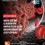 El responsable de Vigilancia Epidemiológica de la Dirección de Salud de Cotopaxi informó que en la provincia se han registrado más de 90 casos de hepatitis tipo A.