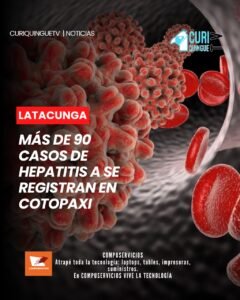 El responsable de Vigilancia Epidemiológica de la Dirección de Salud de Cotopaxi informó que en la provincia se han registrado más de 90 casos de hepatitis tipo A.
